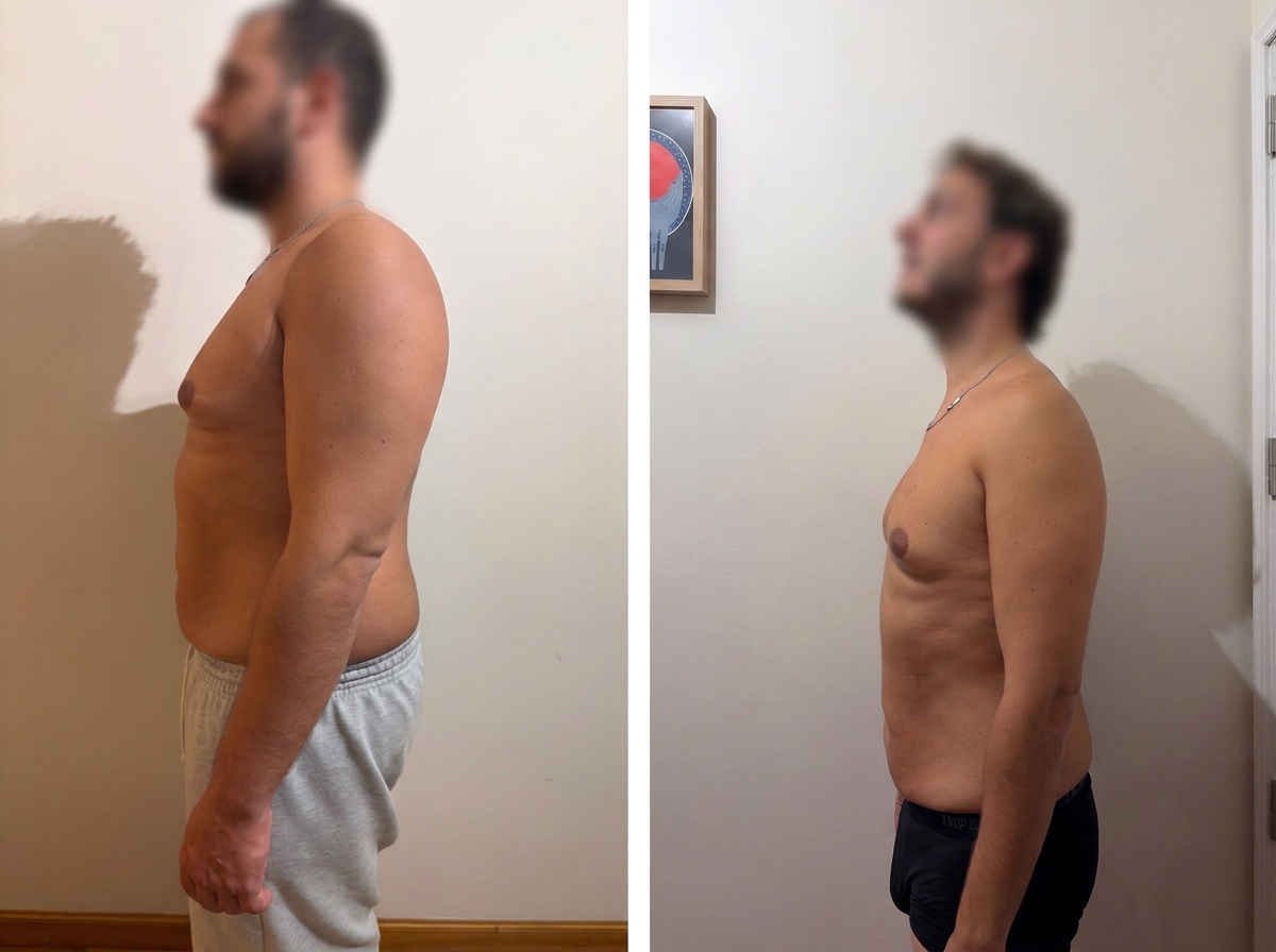Comparação real de evolução física masculina vista de perfil, com rostos fortemente desfocados